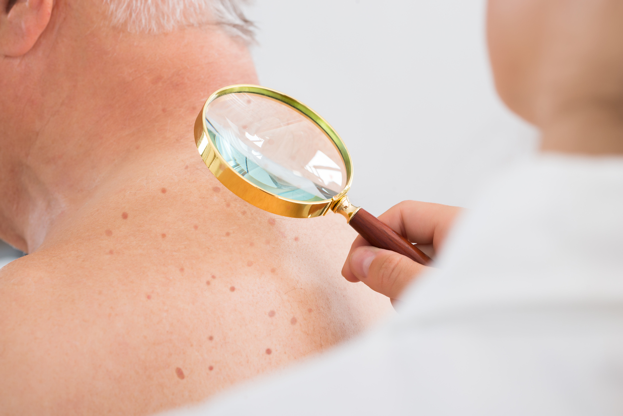 May is: Melanoma/Skin Cancer Detection & Prevention Month